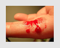 Eyecatcher_download_blut_version_1